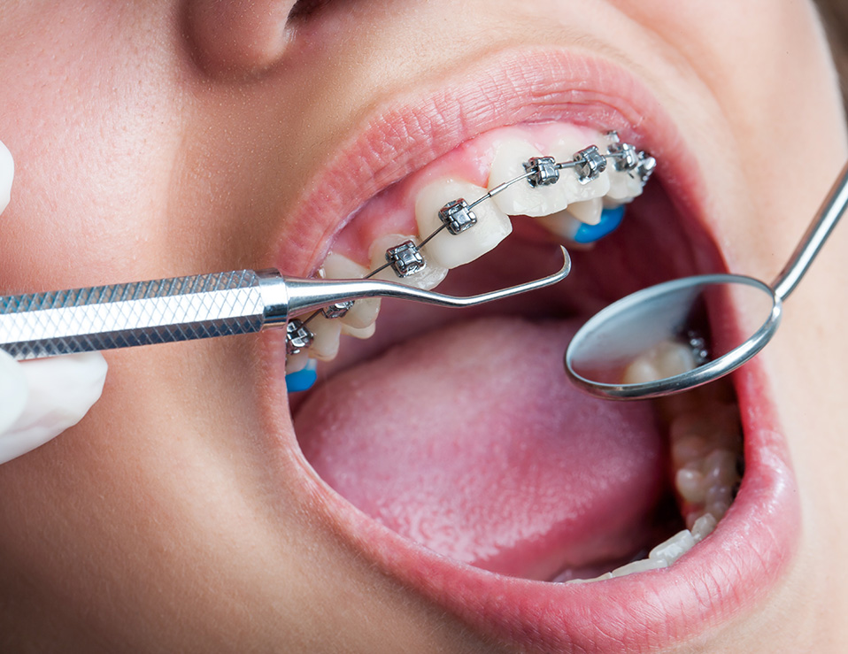 Orthodontics-Image-sized