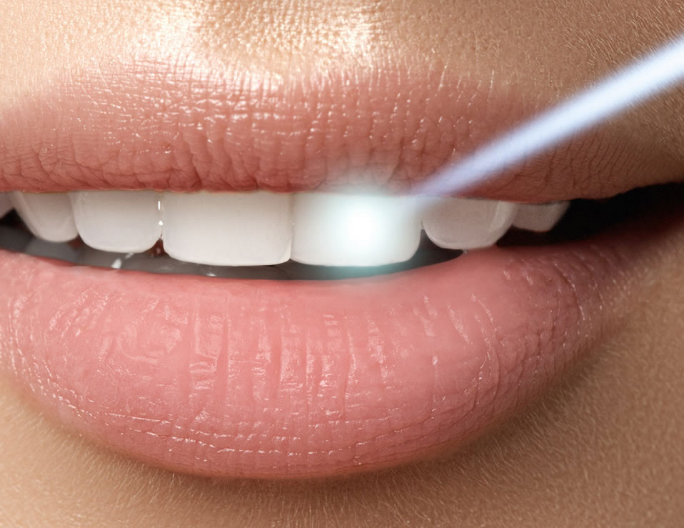 laser_pic