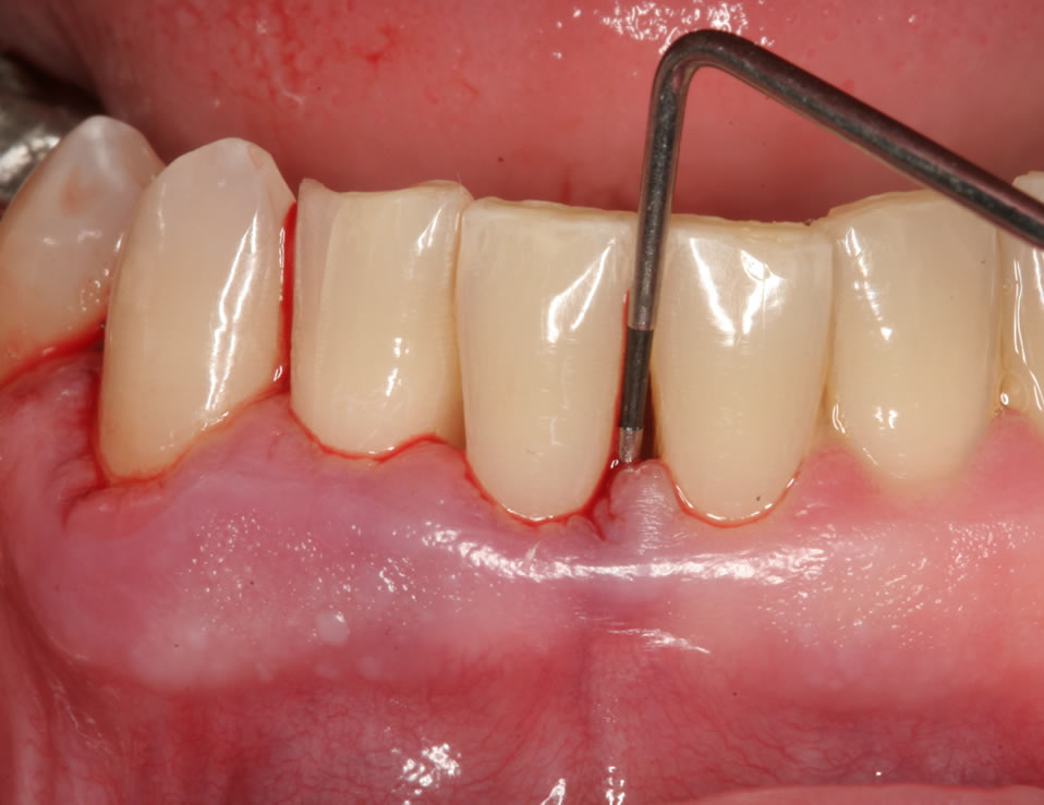periodontist_pic