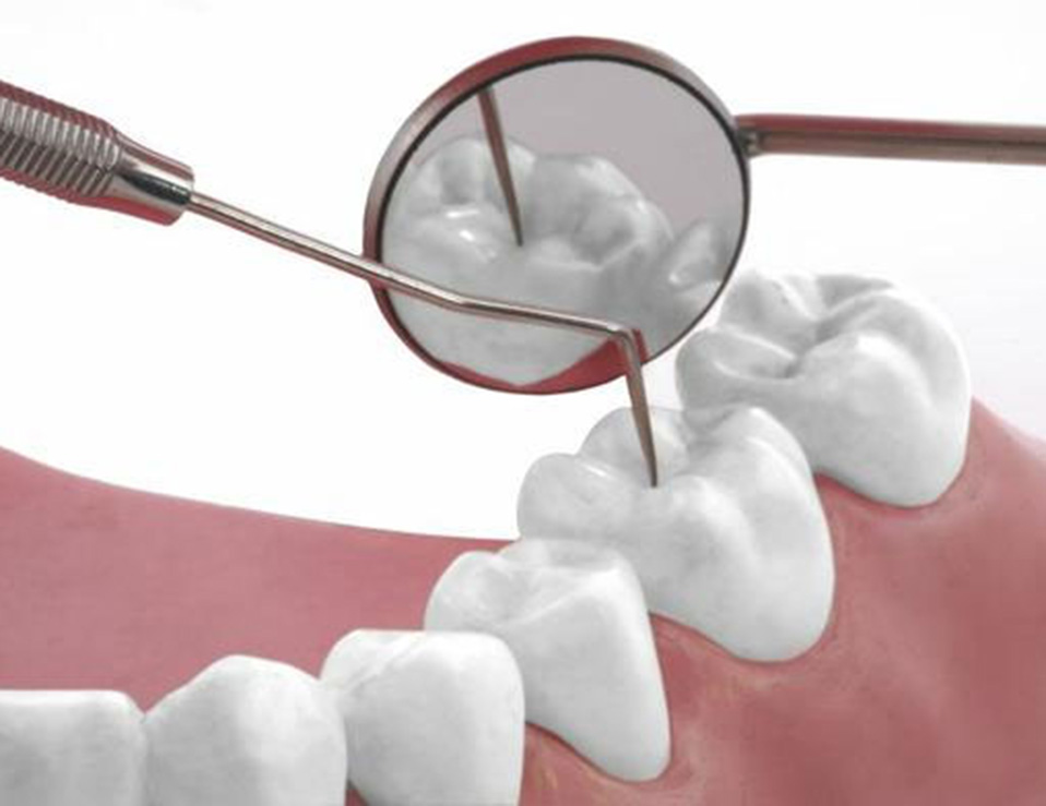 tooth-white-filling-sized